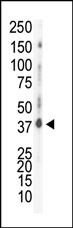 AP14044PU-N - Casein kinase I delta
