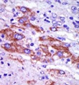 AP14044PU-N - Casein kinase I delta