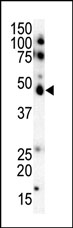 AP14045PU-N - Casein kinase I epsilon