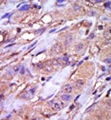 AP14045PU-N - Casein kinase I epsilon