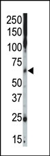 AP14047PU-N - CSNK1G2