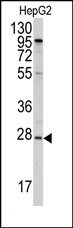 AP14057PU-N - Apolipoprotein A I / APO AI