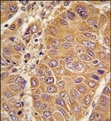 AP14057PU-N - Apolipoprotein A I / APO AI