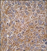 AP14060PU-N - GIT1