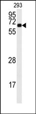 AP14062PU-N - CAMK2A