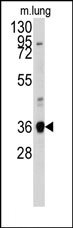 AP14064PU-N - Annexin A2 / ANXA2