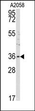 AP14065PU-N - Annexin A2 / ANXA2