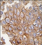 AP14065PU-N - Annexin A2 / ANXA2