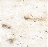AP13782PU-N - MARK1