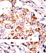 AP13799PU-N - NME3