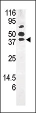 AP13803PU-N - PANK1 / PANK
