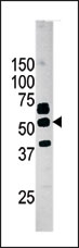 AP13804PU-N - PANK2