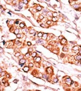 AP13819PU-N - Pyridoxal kinase / PDXK