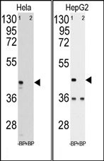 AP13821PU-N - Phosphoglycerate kinase 1 (PGK1)