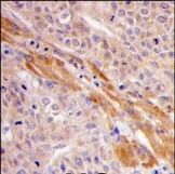 AP13821PU-N - Phosphoglycerate kinase 1 (PGK1)