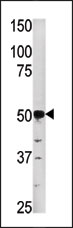 AP13822PU-N - Phosphoglycerate kinase 2 (PGK2)