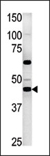 AP13823PU-N - Phosphoglycerate kinase 2 (PGK2)