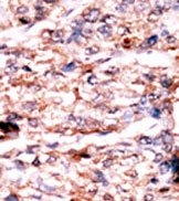 AP13837PU-N - PSKH1