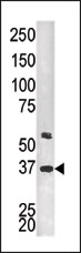 AP13839PU-N - Twinfilin-2 (TWF2)