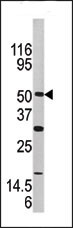 AP13707PU-N - Activin receptor type 1 / ACRV1