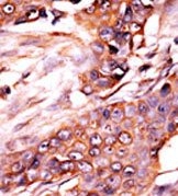 AP13707PU-N - Activin receptor type 1 / ACRV1