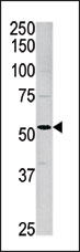 AP13708PU-N - Activin receptor type 1 / ACRV1