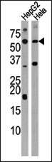 AP13709PU-N - Activin receptor type 1C / ACVR1C
