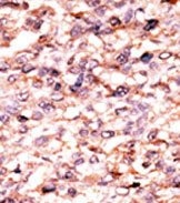AP13709PU-N - Activin receptor type 1C / ACVR1C