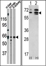 AP13712PU-N - Activin receptor type 2A / ACVR2A