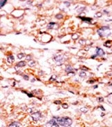 AP13712PU-N - Activin receptor type 2A / ACVR2A