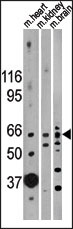 AP13714PU-N - Activin receptor type 2B / ACVR2B