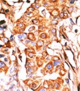 AP13758PU-N - Glycerol kinase 2