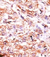 AP13760PU-N - GCS-alpha-2 / GUCY1A2