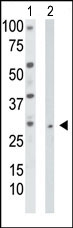 AP13622PU-N - Thymidine kinase 2 (TK2)