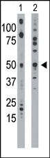 AP13631PU-N - Ethanolamine kinase 1