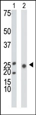 AP13633PU-N - Ketohexokinase