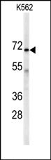 AP13650PU-N - Adenylate kinase 7 / AK7