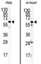AP13652PU-N - Integrin-linked protein kinase