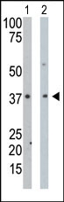 AP13657PU-N - Pyridoxal kinase / PDXK