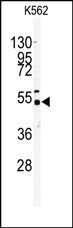 AP13662PU-N - Galactokinase 2