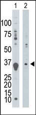 AP13670PU-N - Deoxyguanosine kinase