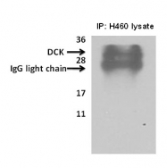 AP13672PU-N - Deoxycytidine kinase
