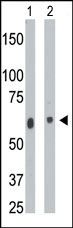 AP13674PU-N - Ceramide Kinase