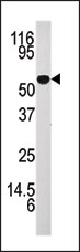 AP13680PU-N - Adenosine kinase