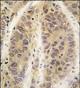AP13680PU-N - Adenosine kinase