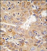AP13683PU-N - Phosphoglycerate kinase 1 (PGK1)