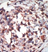 AP13543PU-N - PRKCB