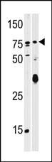 AP13554PU-N - SCYL2