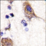 AP13554PU-N - SCYL2