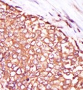 AP13558PU-N - PRKCQ / PRKCT